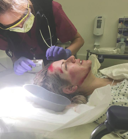 Dana Cray Fernie having a gash sewn up after she was knocked from her bike November 29. Photo: AnnaGrace Arnold