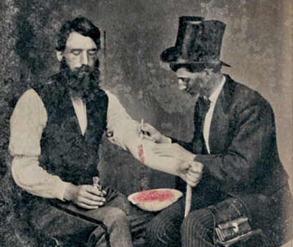 By BurnsArchiveThis photo is from the collection of the Burns Archive.Requested attribution: The Burns Archive - Burns Archive via Newsweek, 2.4.2011., Public Domain, https://commons.wikimedia.org/w/index.php?curid=90618978